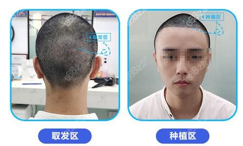 成都恒博取发区和种植区