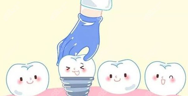 <!--<i data=20240705-sp></i>-->牙科种植牙的价格多少钱