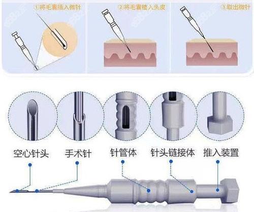 东莞美立方植发好不好