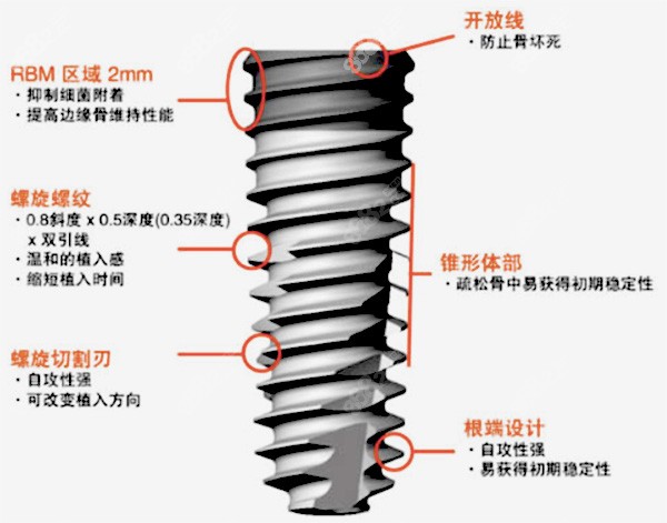 韩国奥齿泰种植体特点