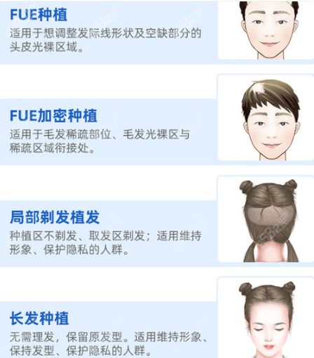 西安<!--<i data=20240705-sp></i>-->植发特色