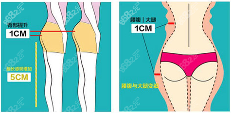 上海吸脂好的医生都有谁呢？