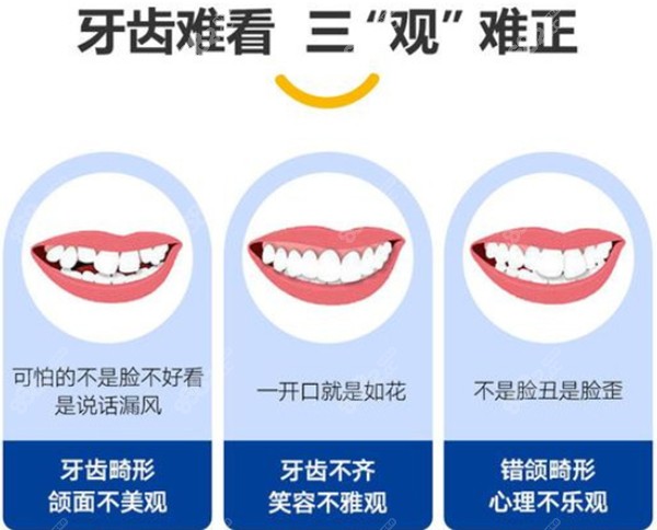 牙齿难看会影响五官