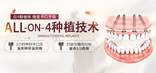 美奥口腔医院的ALL-ON-4种植牙技术