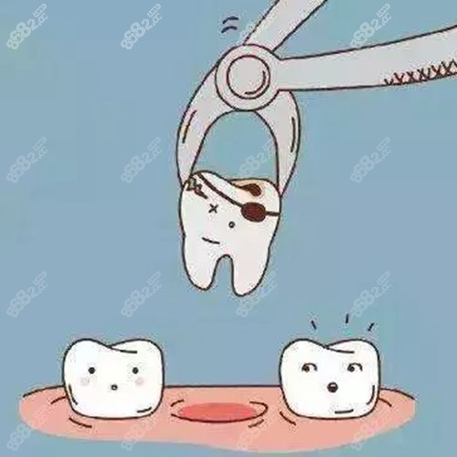 拔牙卡通图