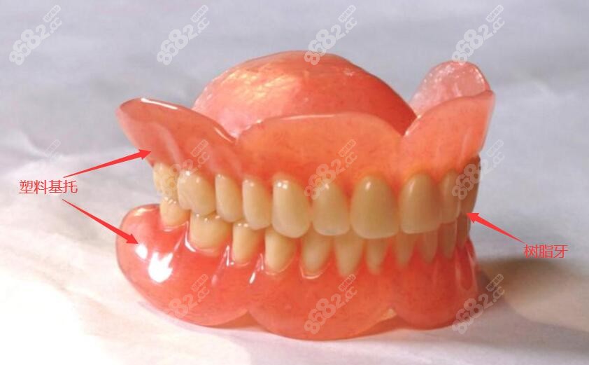 活动义齿结构