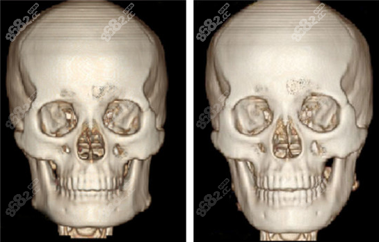 廣州磨骨好的醫(yī)生匯總