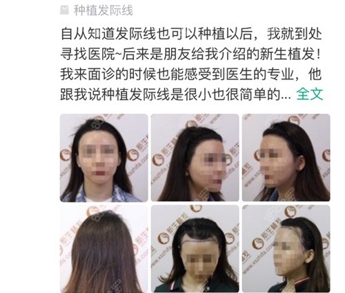 网友在成都<!--<i data=20240705-sp></i>-->植发口碑评价