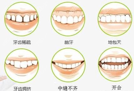 宝山区的牙齿矫正价格费用是多少钱