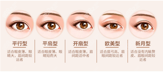 广州健丽整形做双眼皮就是好