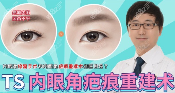 韩国TS内眼角疤痕重建手术
