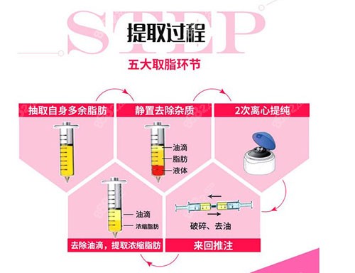 成都艾米丽吸脂手术过程