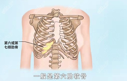 肋软骨图片位置示意图图片