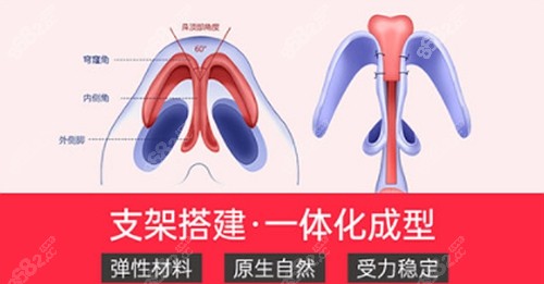 李昕做耳软骨鼻综合的优势