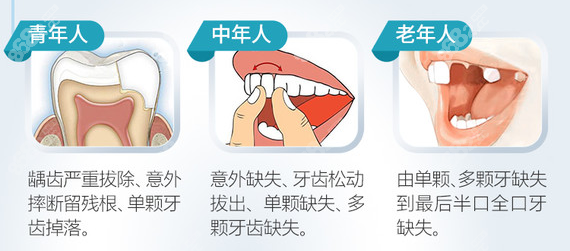 成都种植牙排名前十医院里面这三家做的比价好