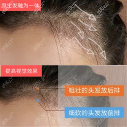 南昌碧莲盛植发优势
