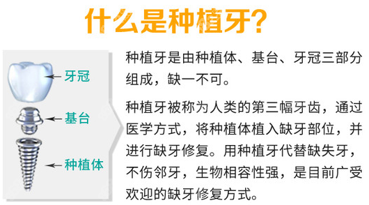 长沙十大口腔医院排名里面，这三家种植牙齿技术是真的好