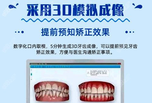 南京美奥口腔医院3D矫正模拟成像