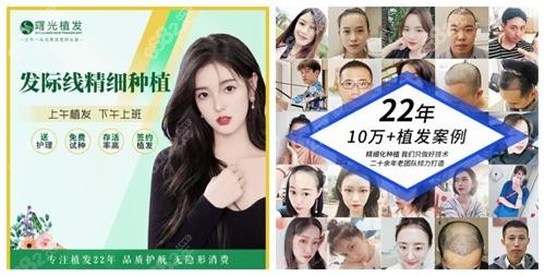合肥曙光植发