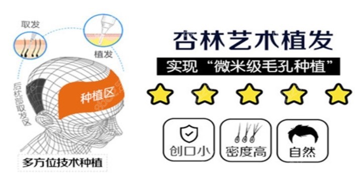 沈阳杏林植发优势