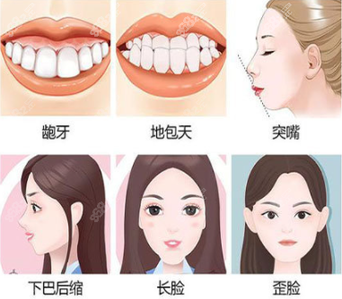 正頜手術(shù)適應(yīng)癥