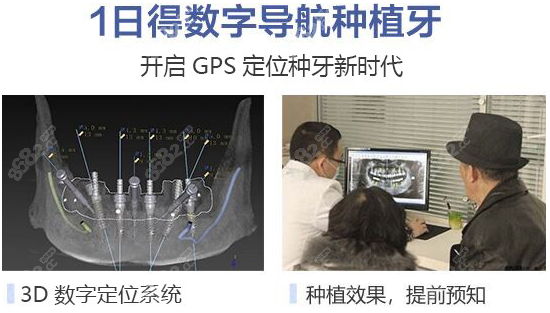 <!--<i data=20240705-sp></i>-->1日得种牙技术