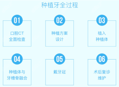 郑州拜博口腔种植牙齿流程