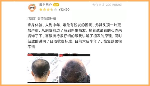 南京<!--<i data=20240705-sp></i>-->植发发友点评