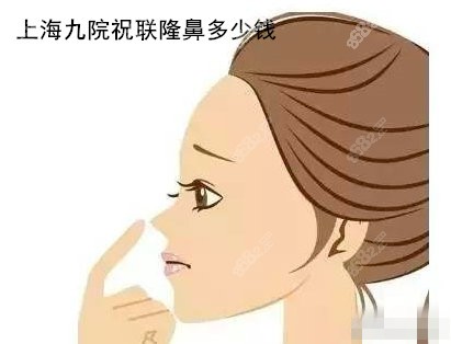 的<!--<i data=20240705-sp></i>-->医生隆鼻多少钱
