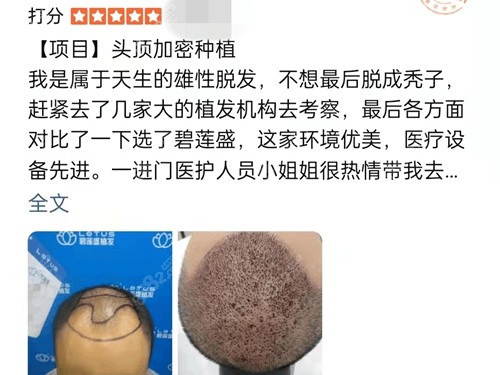 碧莲盛植发口碑好吗 碧莲盛植发口碑好吗