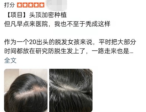 <!--<i data=20240705-sp></i>-->植发口碑怎么样 <!--<i data=20240705-sp></i>-->植发口碑怎么样