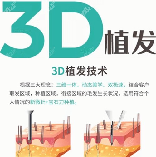 <!--<i data=20240705-sp></i>-->植发怎么样 <!--<i data=20240705-sp></i>-->植发怎么样