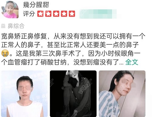 西安国 际医学<!--<i data=20240705-sp></i>-->师俊莉隆鼻口碑怎么样