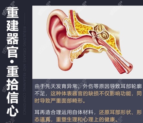重庆市第四人民医院耳再造优势