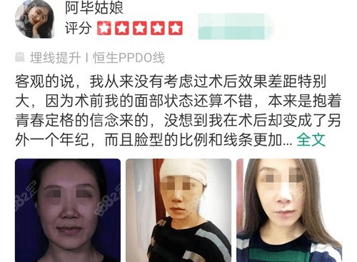 北京加减美医疗美容医院拉皮手术口碑评价