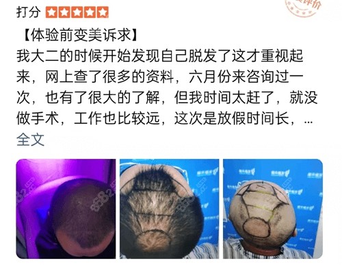 洛阳<!--<i data=20240705-sp></i>-->植发口碑怎么样 洛阳<!--<i data=20240705-sp></i>-->植发口碑怎么样