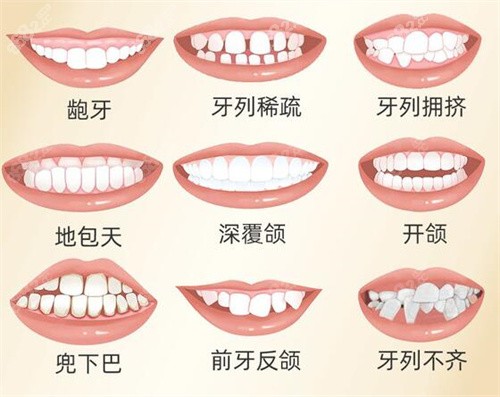 需要隐形矫正的情况