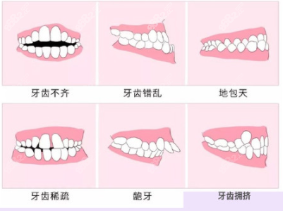 上海美奥牙齿矫正