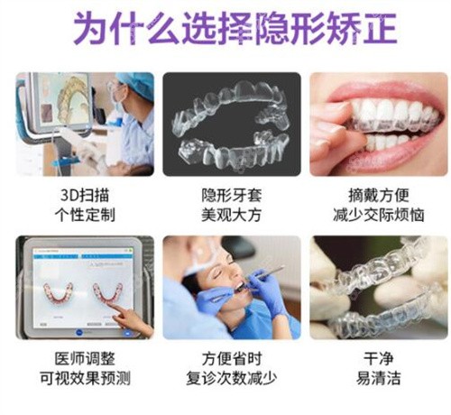 北京隐形矫正的6大优势