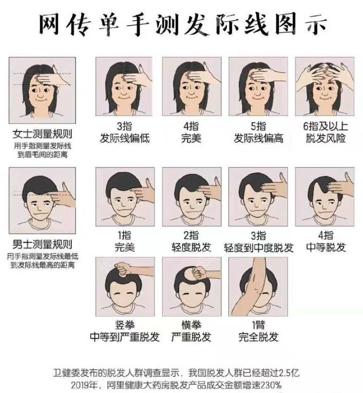 上海植发方法(上海植发有害处吗)