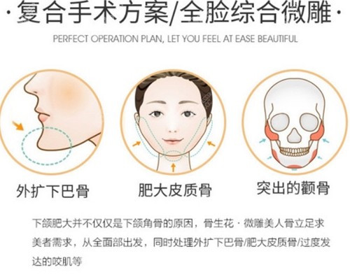 杭州整形下颌角磨骨优势介绍