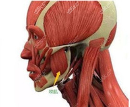 河南赵绛波做下颌角手术切除不分咬肌