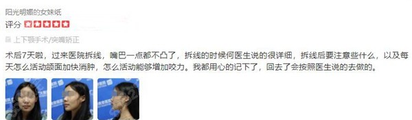 广州广大正颌手术恢复