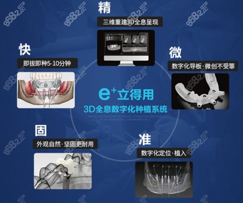 北京方庄中诺口腔立得用种植牙