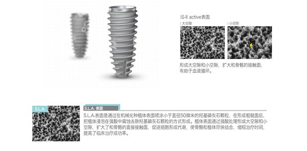 纽百特种植体凹槽设计