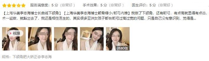 找李志海磨颧骨下颌角手术经历