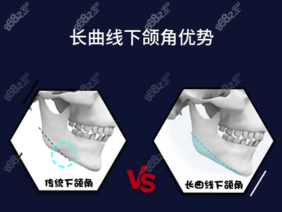 上海华美磨骨怎么样