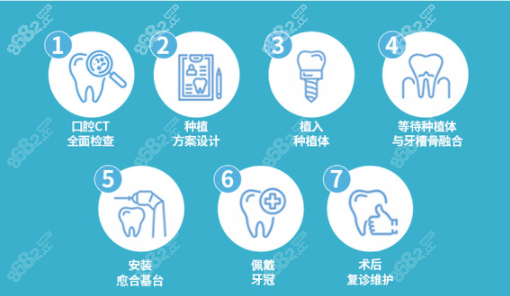 牙齿种植流程示意图