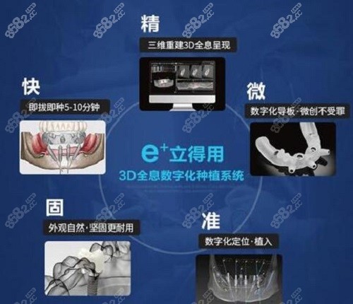 立得用种植牙技术优势