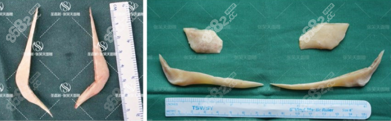 温柔的猫截下的骨头，咬肌